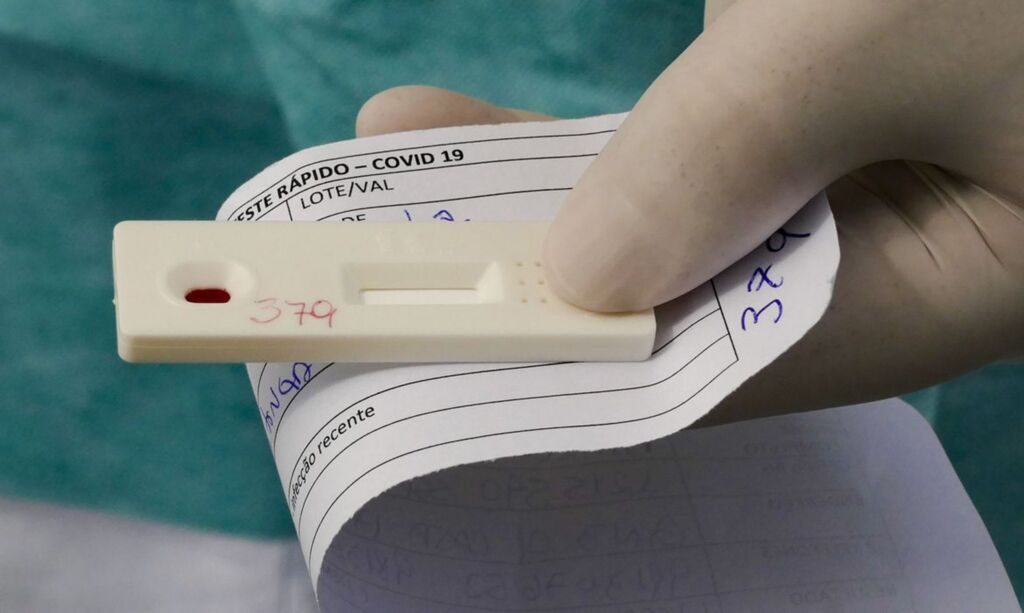 Brasil ultrapassa seis milhões de casos de Covid-19