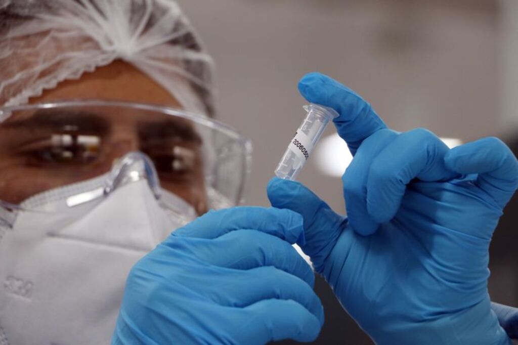 Casos de Covid-19 caem 30% e mortes 13% em novo boletim epidemiológico no Brasil