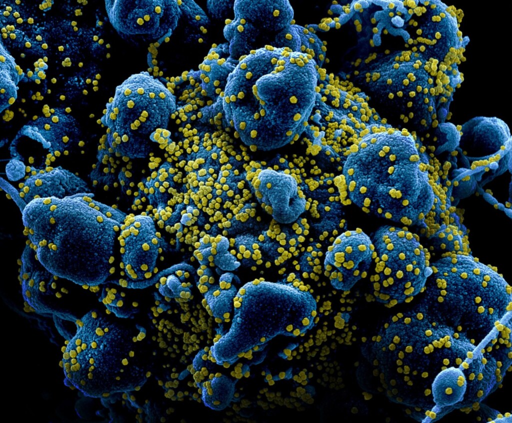 Pelotas confirma 60 novas infecções por coronavírus