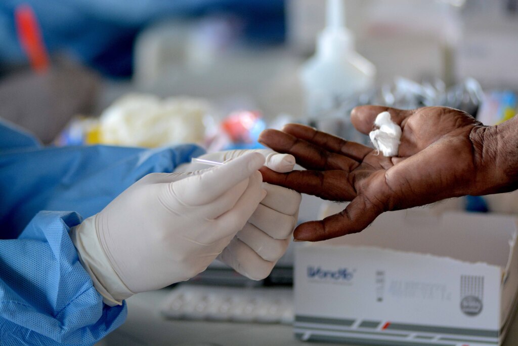 Brasil mantém alta de casos diários de Covid-19