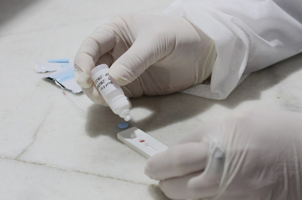 Pelotas tem 20 novos casos de Covid-19