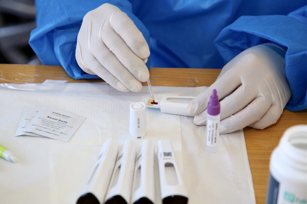 Pelotas registra mais quatro casos de Covid-19