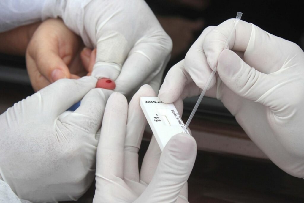 Ação do Sest Senat aplica testes para Covid-19