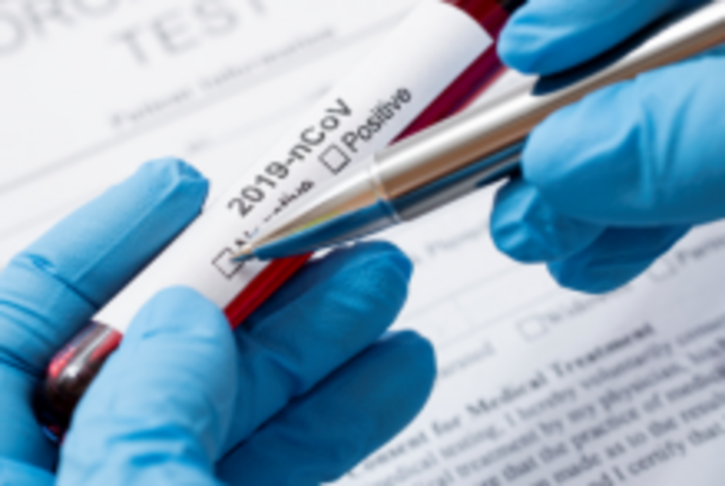 Pelotas registra mais cinco casos de Covid-19