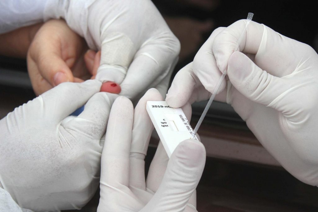 Sest Senat vai aplicar testes para a Covid-19