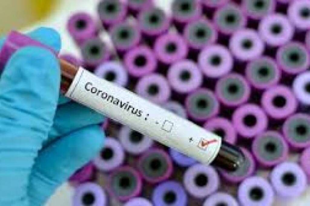 Pelotas tem mais um caso de Covid-19 e atinge total de 47 infectados