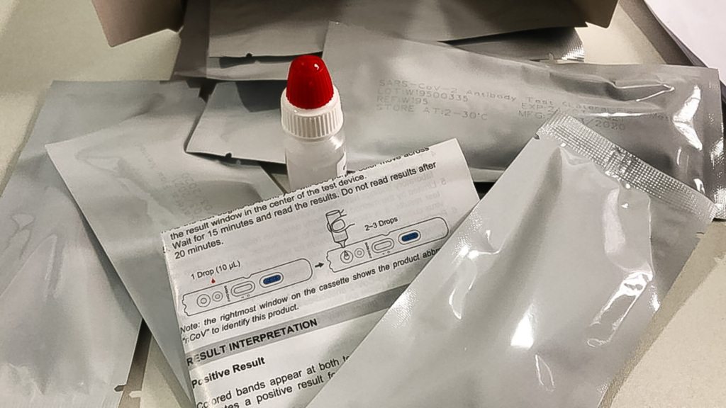 Pelotas realizou cerca de 1,8 mil exames para a Covid-19
