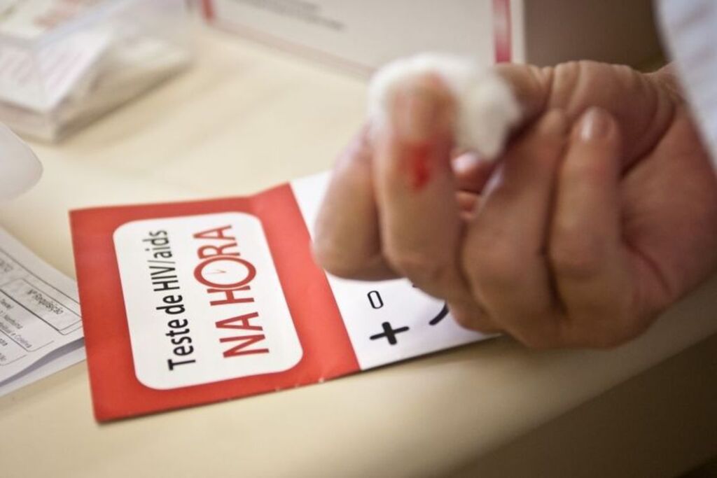 Tempo de vida de pessoas com HIV mais que dobra no Brasil