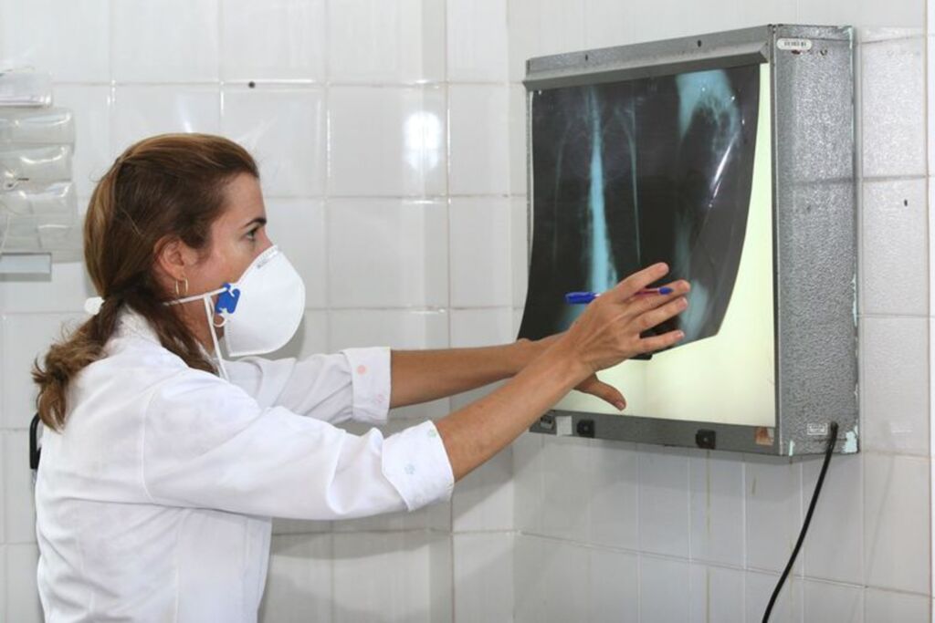Tuberculose: a doença infecciosa mais mortal do mundo