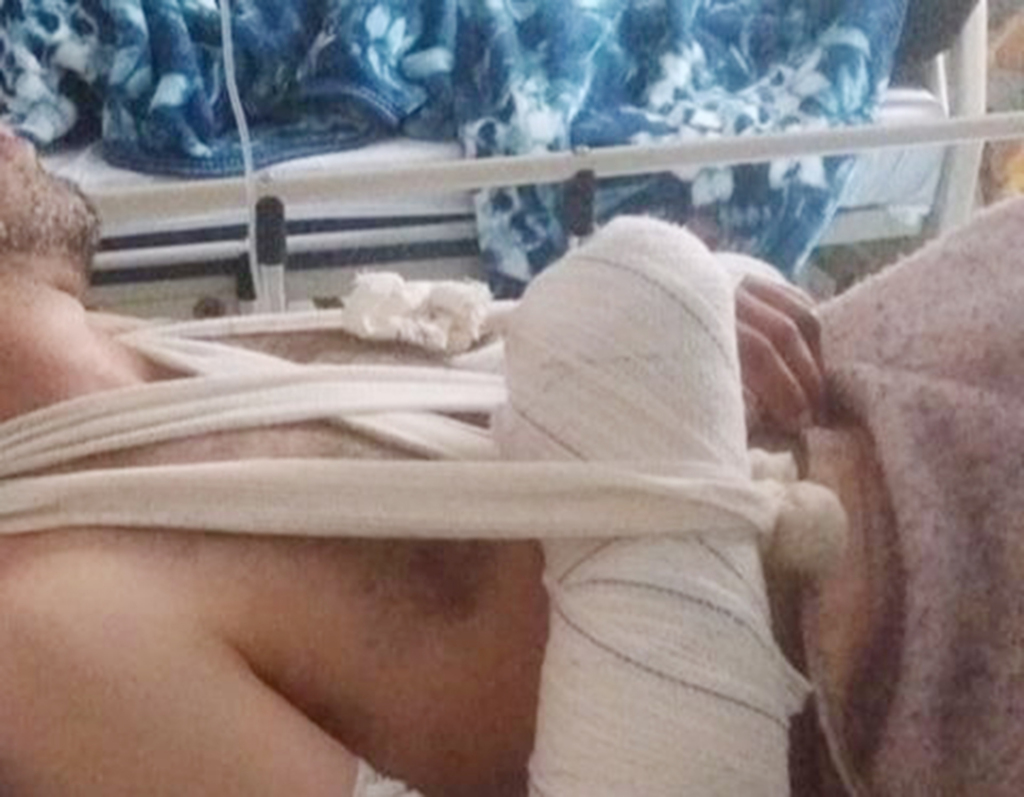Colisão com bovino na SC-390 deixa motociclista bastante ferido