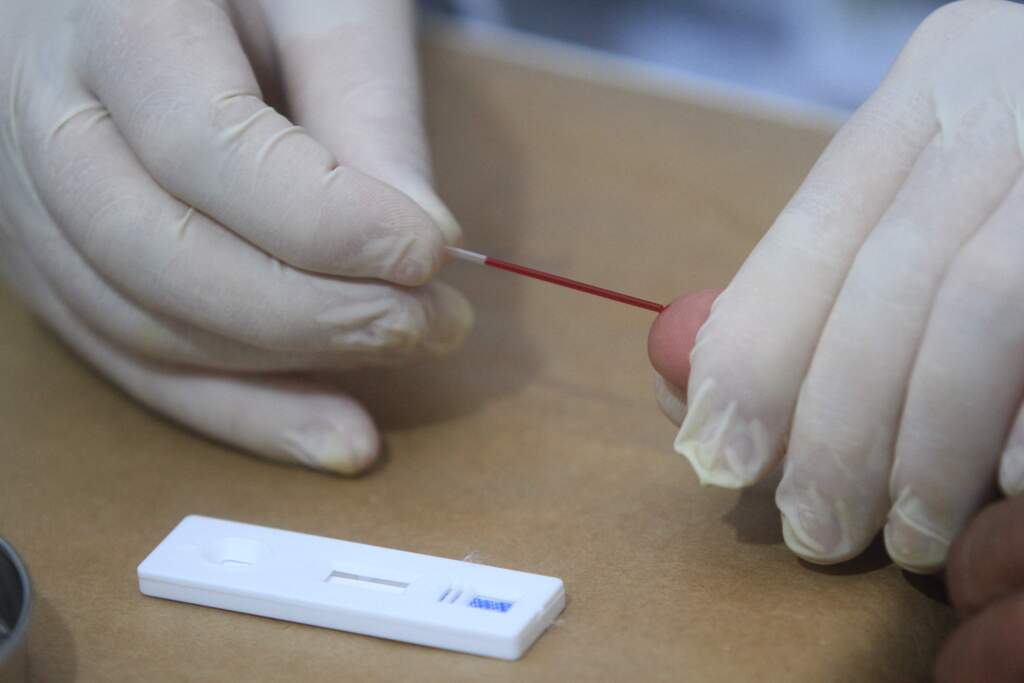 Brasil pretende eliminar hepatite C até 2030, diz ministro da Saúde