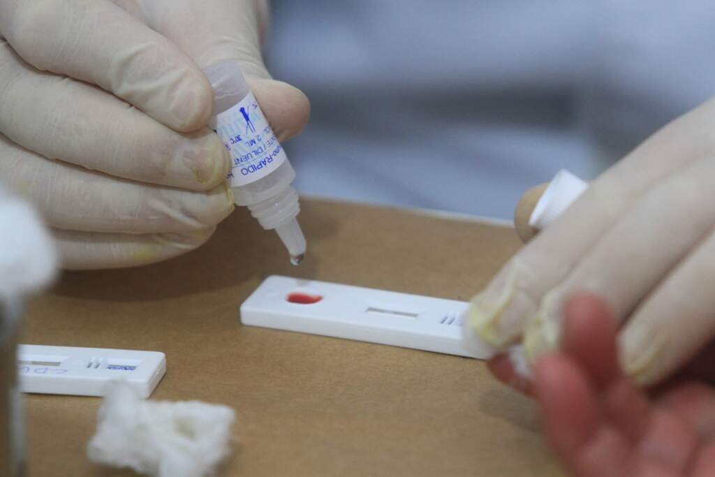 Ampliação do tratamento para Hepatite C é aprovada