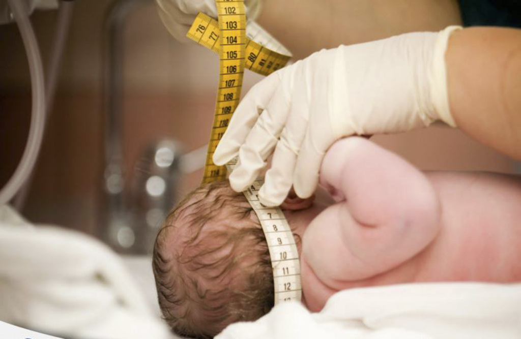 Países afetados pelo Zika devem dar direito a aborto, diz ONU