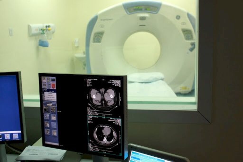 Câmara de Canoinhas libera verba para compra de novo tomógrafo