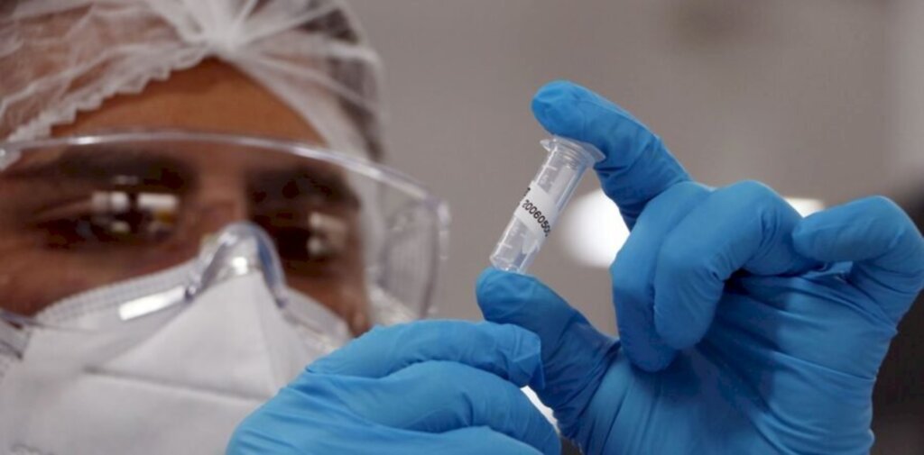 Planalto Norte ultrapassa 2 mil casos e chega a 34 mortes causadas pela covid-19