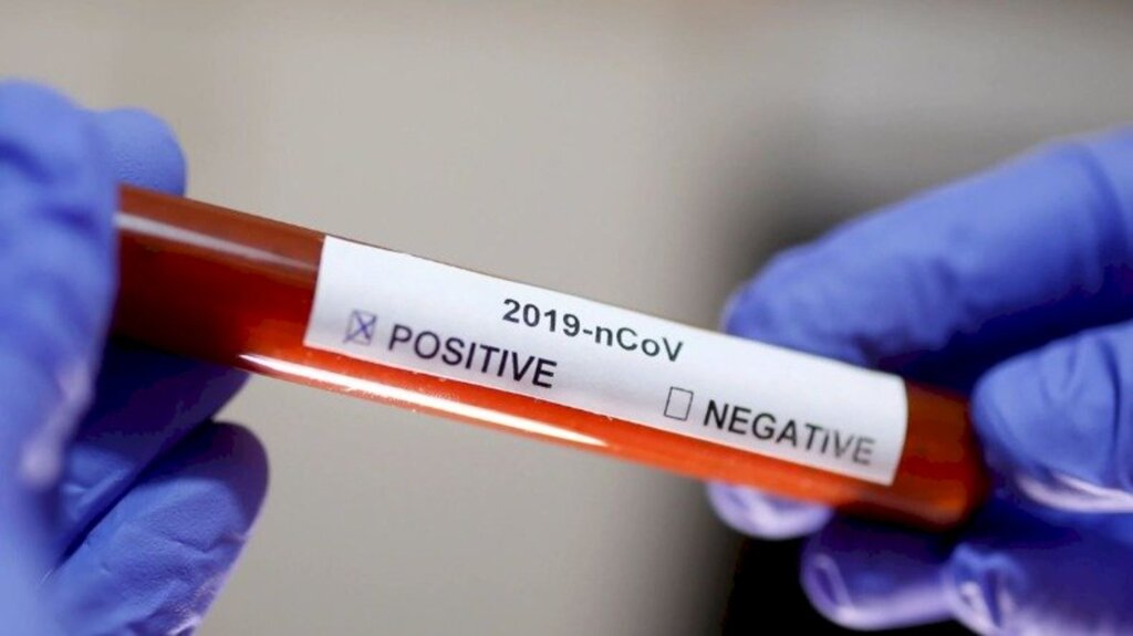 Indaial: Mais de 1.300 testes de Covid-19 são realizados na primeira quinzena de março