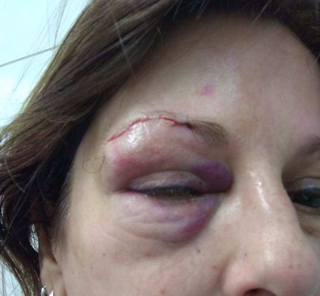 Jovem que agrediu professora se apresenta à promotoria nesta sexta-feira