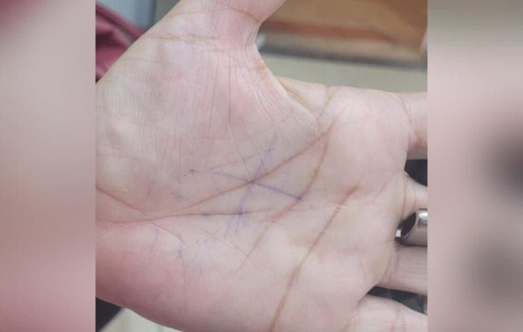 Homem é preso após mulher desenhar 'X' na mão para pedir ajuda em SC