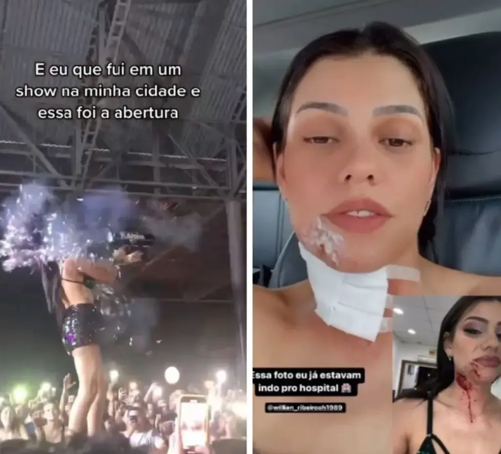 DJ dispara acidentalmente canhão de confetes no rosto e segue show mesmo sangrando