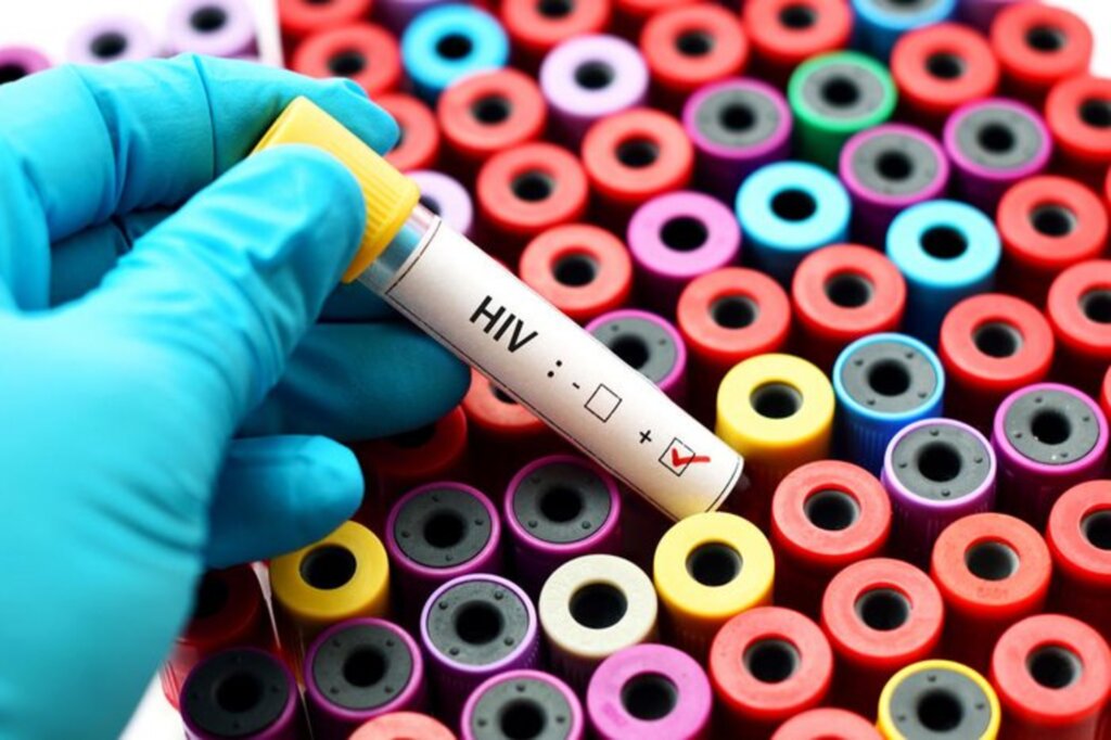 Vacina contra o HIV se mostra ineficaz em testes clínicos