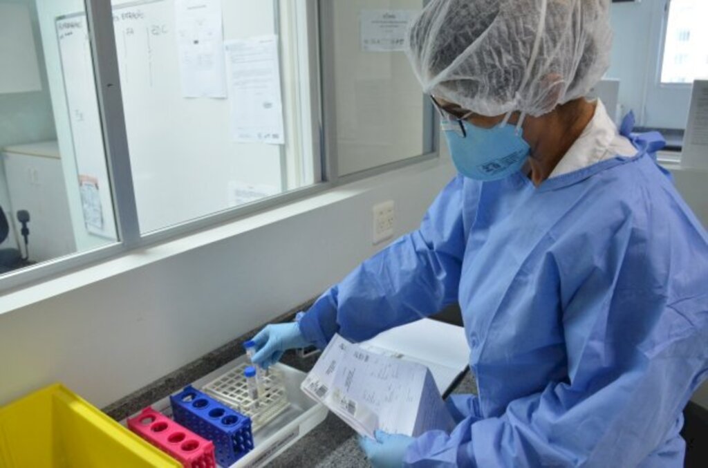 Robson Valverde / SES - O Lacen está realizando exames para identificação do novo coronavírus