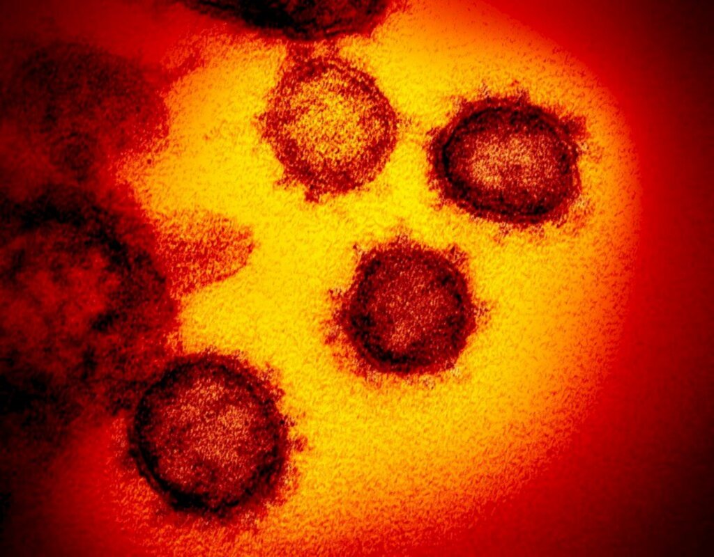 NIAID-RML/AP - Imagem de microscópico mostra o novo coronavírus, responsável pela doença chamada Covid-19