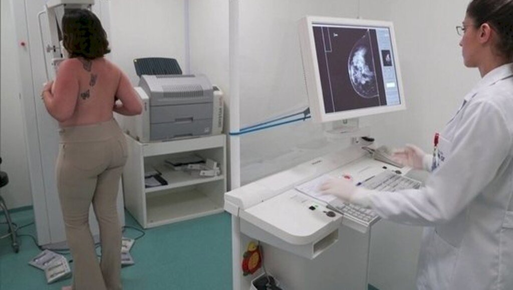 GloboNews. - Mamografia é o principal exame para o diagnóstico precoce do câncer de mama
