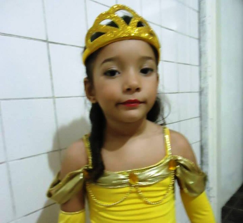  - Cabelo de Rachel ficou preso em um ralo da piscina de hotel (Foto: Arquivo Pessoal)