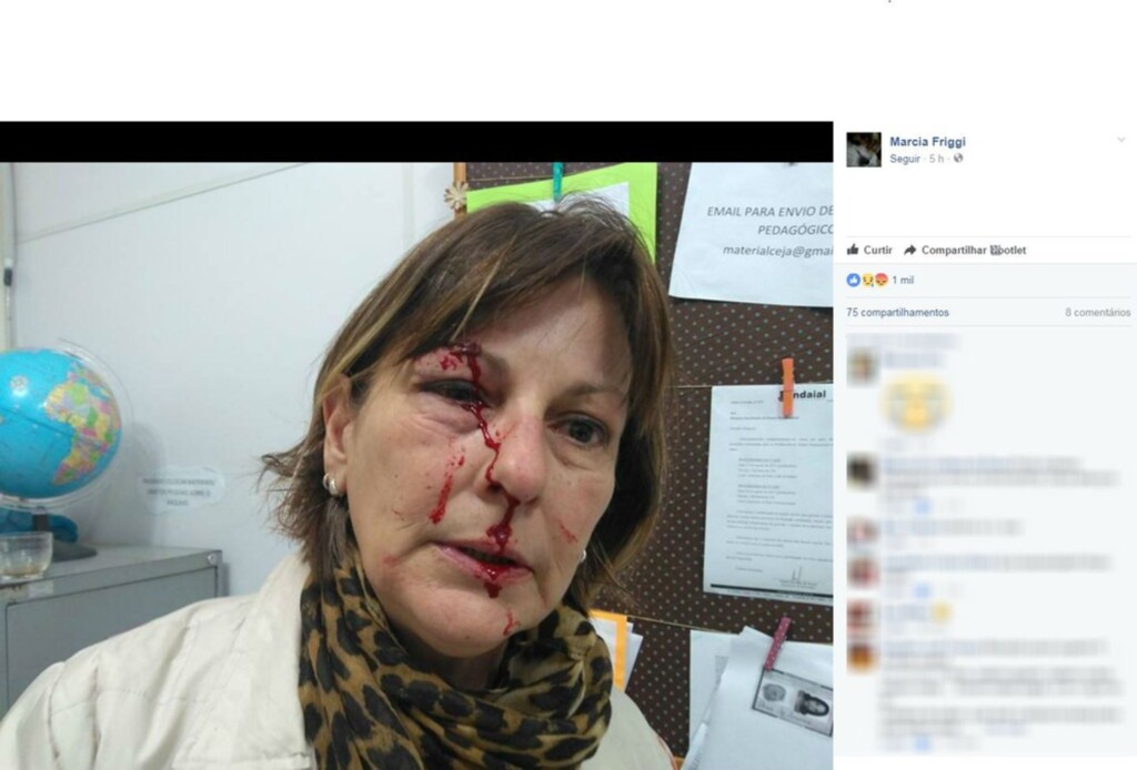 'Já atingiram meu olho, mas não vão me calar': Professora agredida por aluno denuncia mensagens de ódio