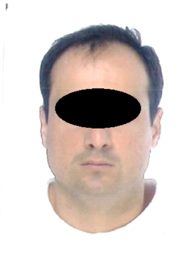 HOMEM É PRESO POR DIREÇÃO PERIGOSA EM TORRES