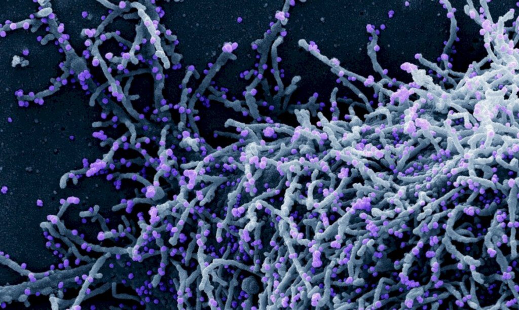 © National Institute of Allergy and Infectious Diseases /NIAID/Direitos reservados - 