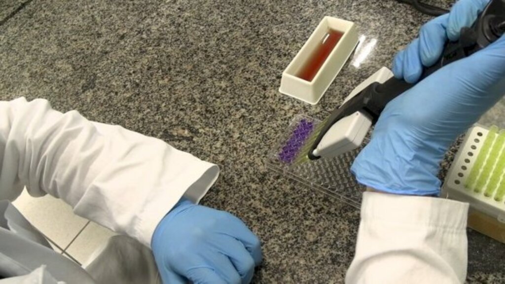CORONAVÍRUS EM SC: FAPESC APOIA DESENVOLVIMENTO DE TESTE RÁPIDO PARA COVID-19 MAIS SEGURO