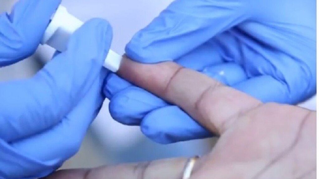 Luís André / Secom - Basta a coleta de uma gota de sangue e o resultado é processado em 15 minutos -