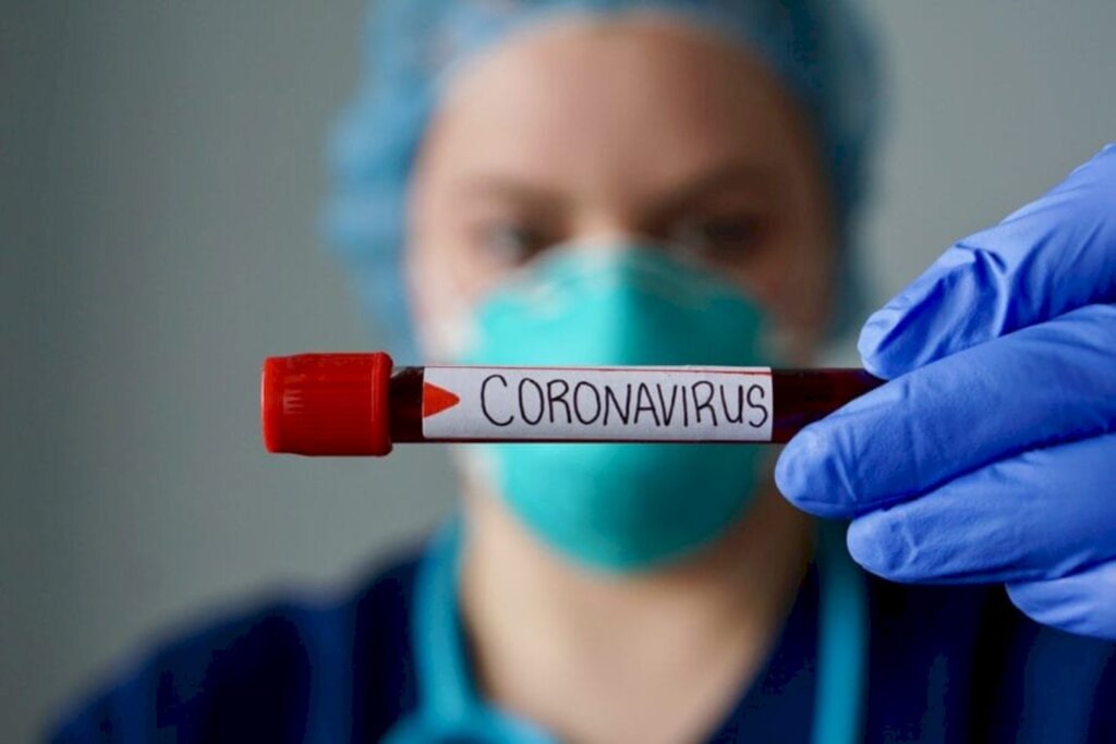 AMESC: REGIÃO TERMINA A SEXTA-FEIRA (08) COM 75 CASOS CONFIRMADOS DE COVID-19