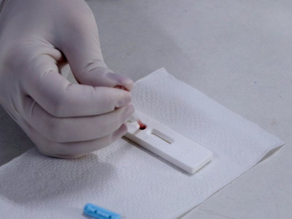 Santa Maria registra três novos casos de coronavírus em 24h