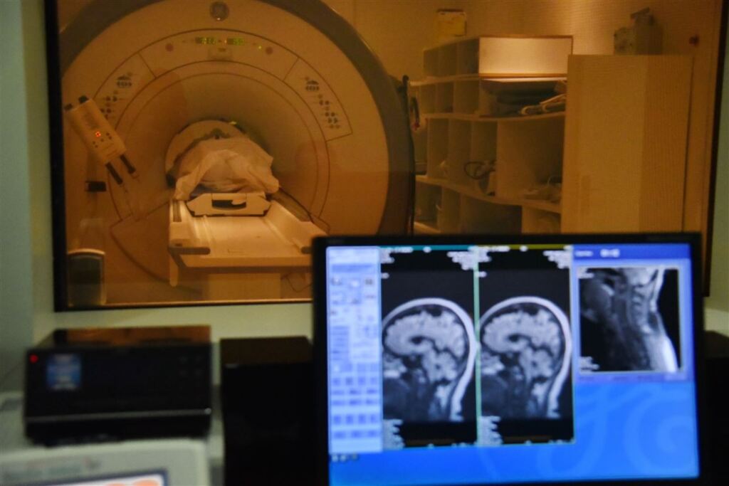 Ainda faltam radiologistas no Hospital Universitário de Santa Maria