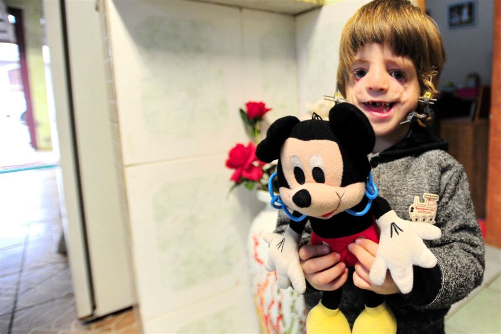 Fotos: Renan Mattos (Diário) - O garoto não se separa do Mickey que ganhou um 