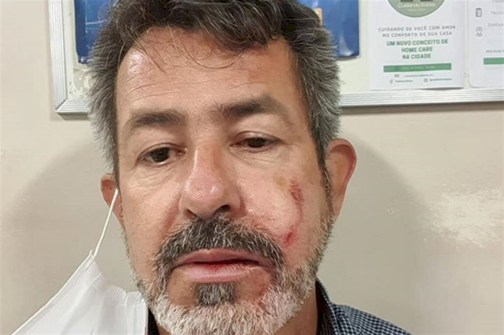 Secretário de Mobilidade Urbana é atingido por pedrada durante carreata