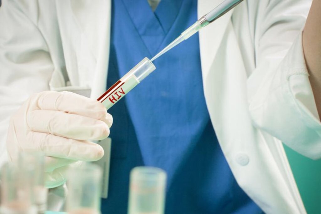 Estudo aponta paciente com HIV curado após transplante de células-tronco