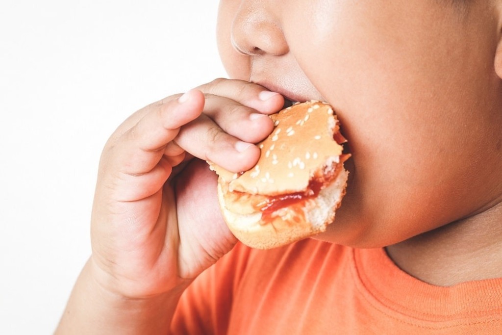 Obesidade infantil: é preciso reeducar os pais