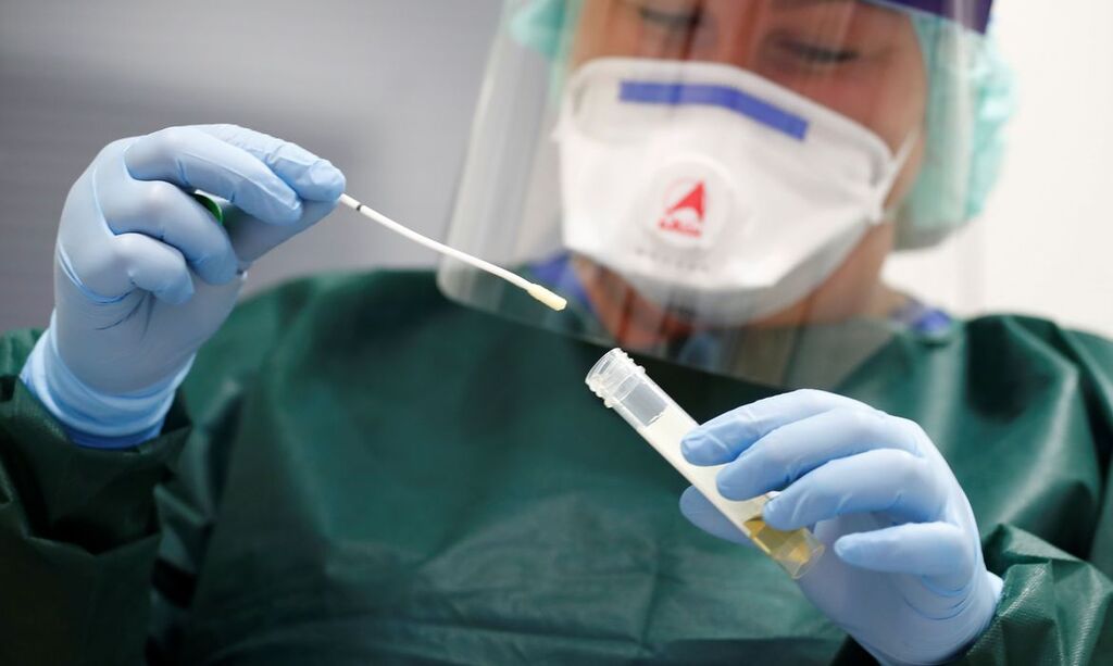 Foto: Agência Brasil - 18 casos suspeitos aguardam análise laboratorial