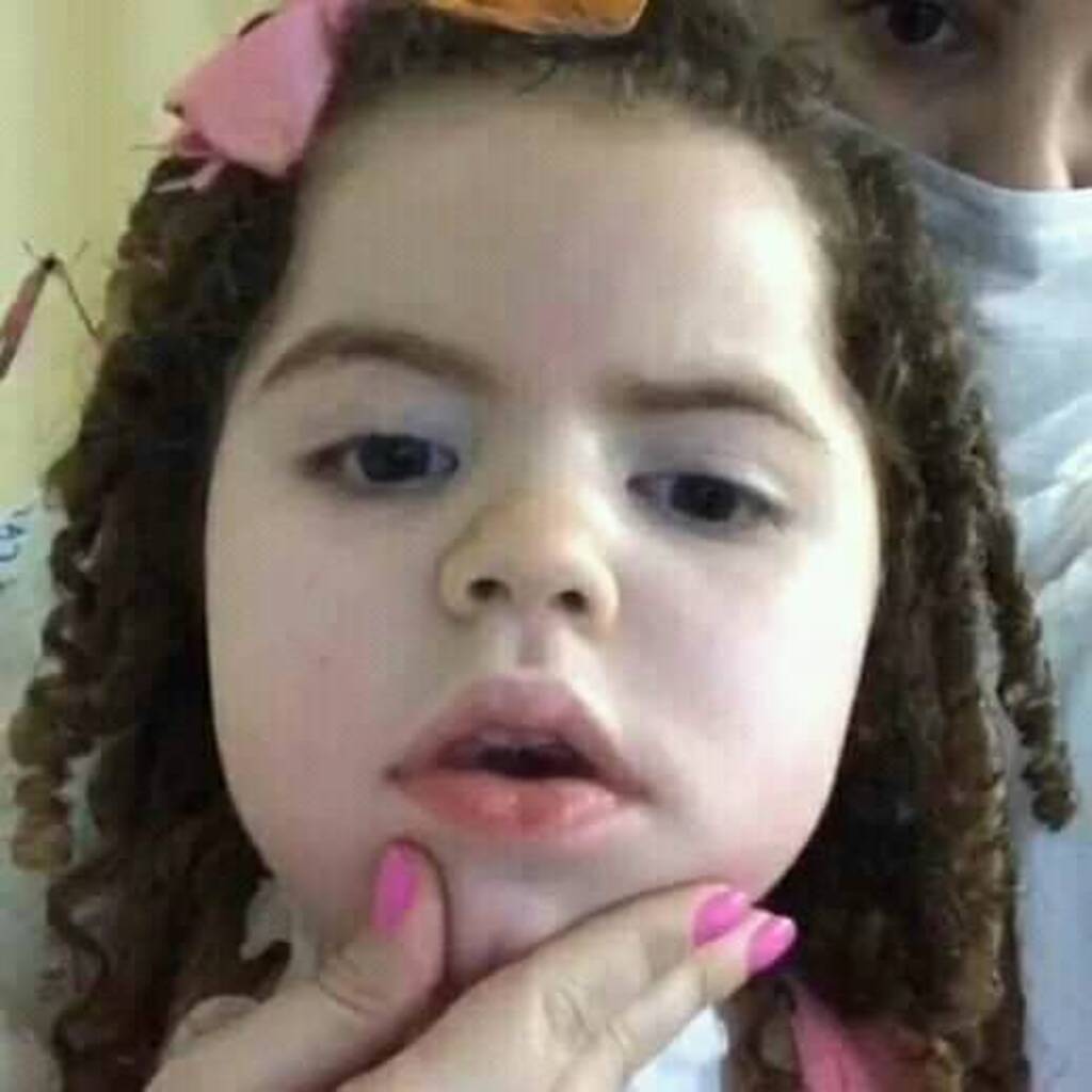 Morre aos 7 anos Aisha Saldanha, que lutava contra <strong>Atrofia Muscular Espinhal</strong>