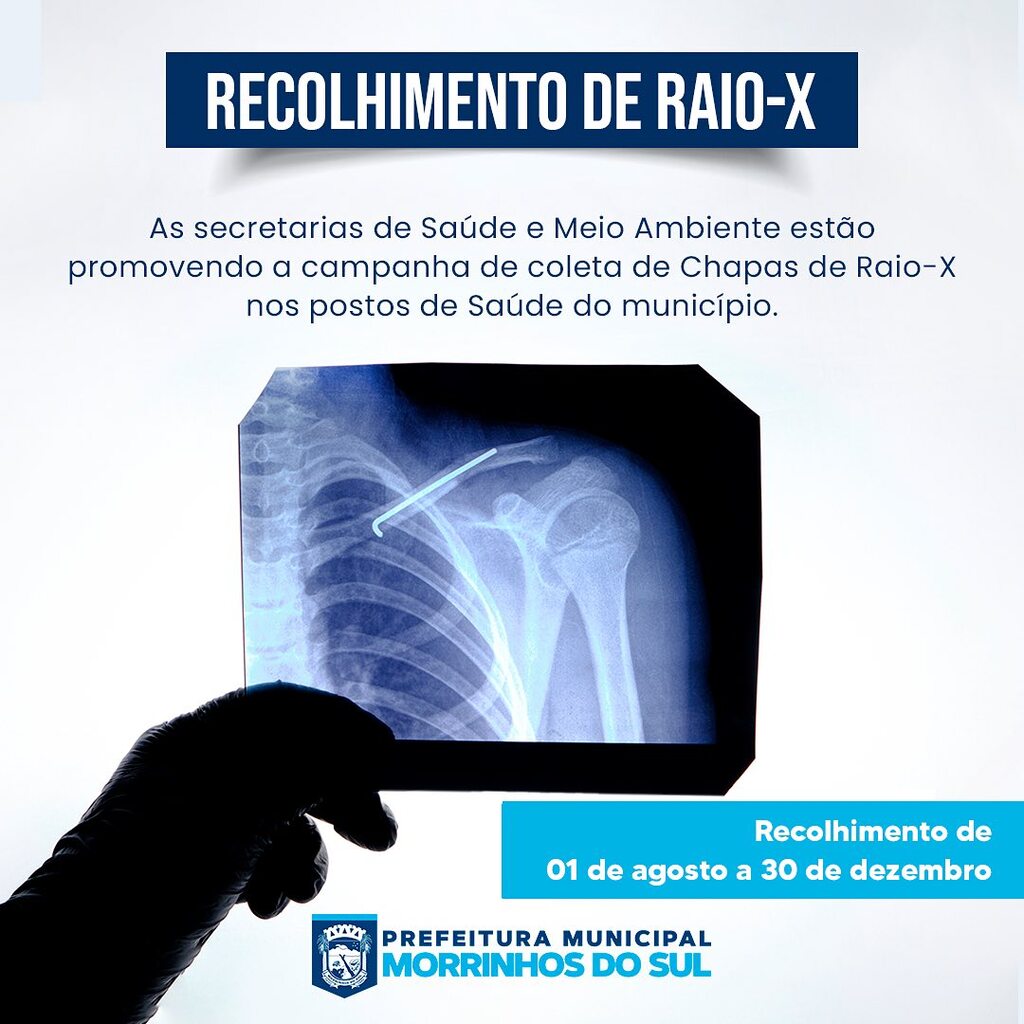 MORRINHOS DO SUL REALIZA CAMPANHA “DESCARTE CORRETAMENTE SUAS CHAPAS DE RAIO-X”