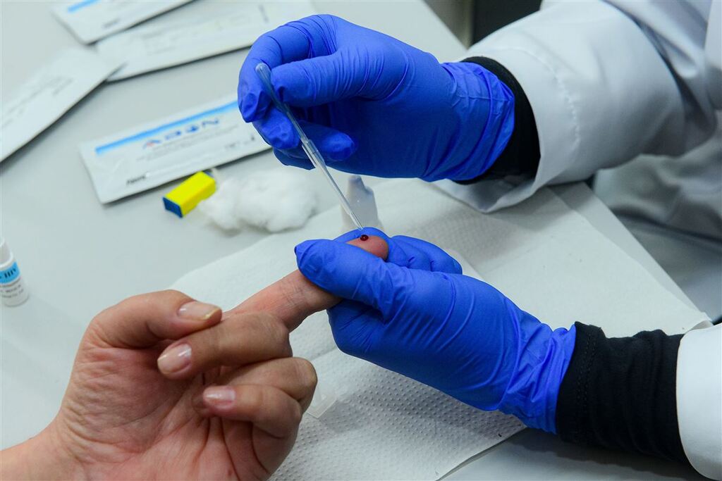 Sífilis e HIV: Ministério da Saúde vai investir R$ 27 milhões em novo teste rápido