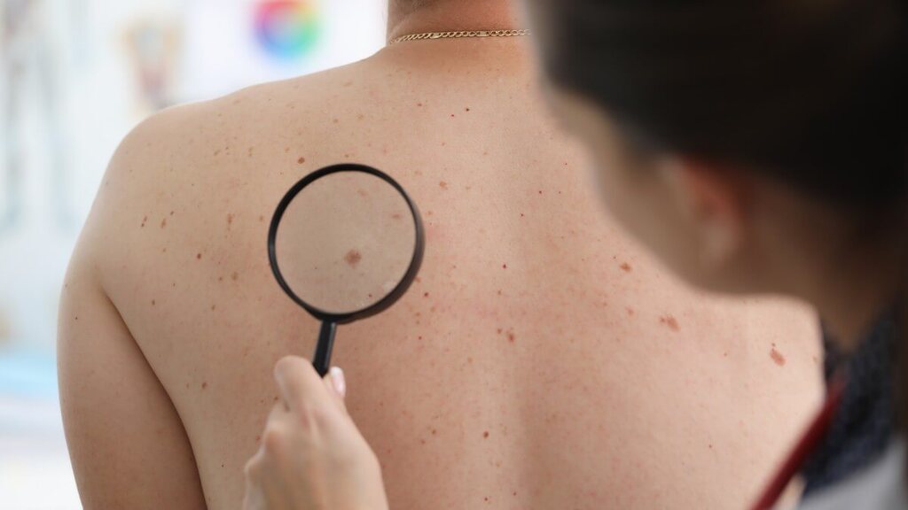 Uruguaiana terá mutirão de dermatologia