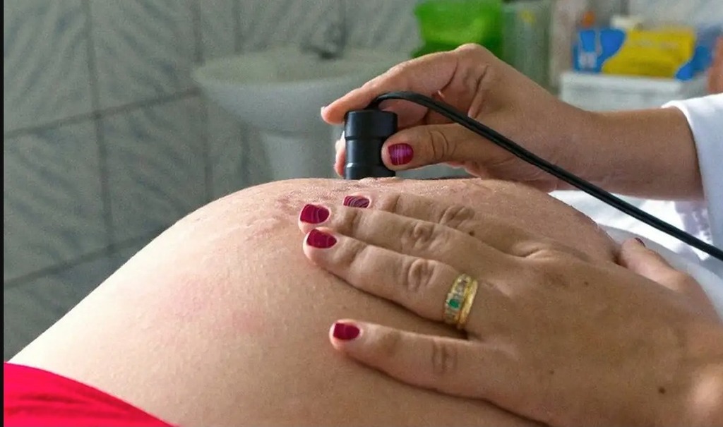 Lei permite a presença de doulas nas maternidades de Pelotas