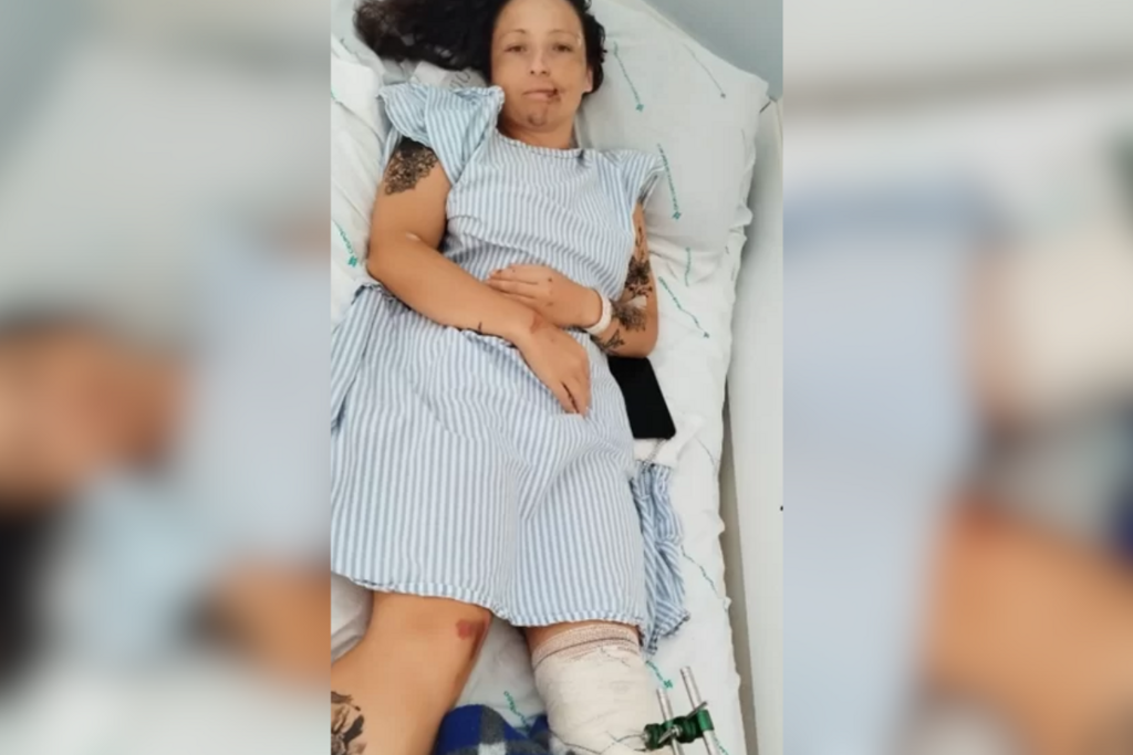 Família de mulher atropelada em rodovia da região organiza vaquinha para realização de cirurgia