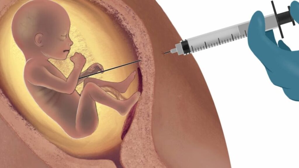 CFM aprova resolução que proíbe a morte de bebês no ventre materno com o uso do cloreto de potássio
