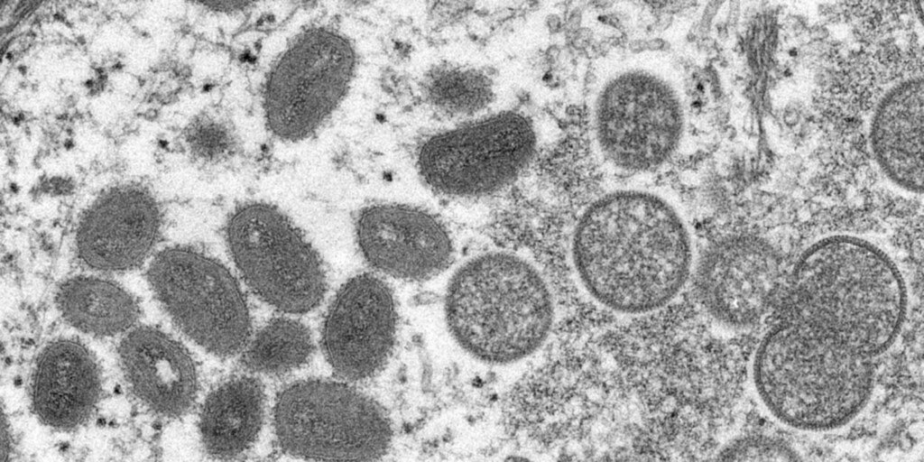 SC confirma primeiro caso de varíola dos macacos