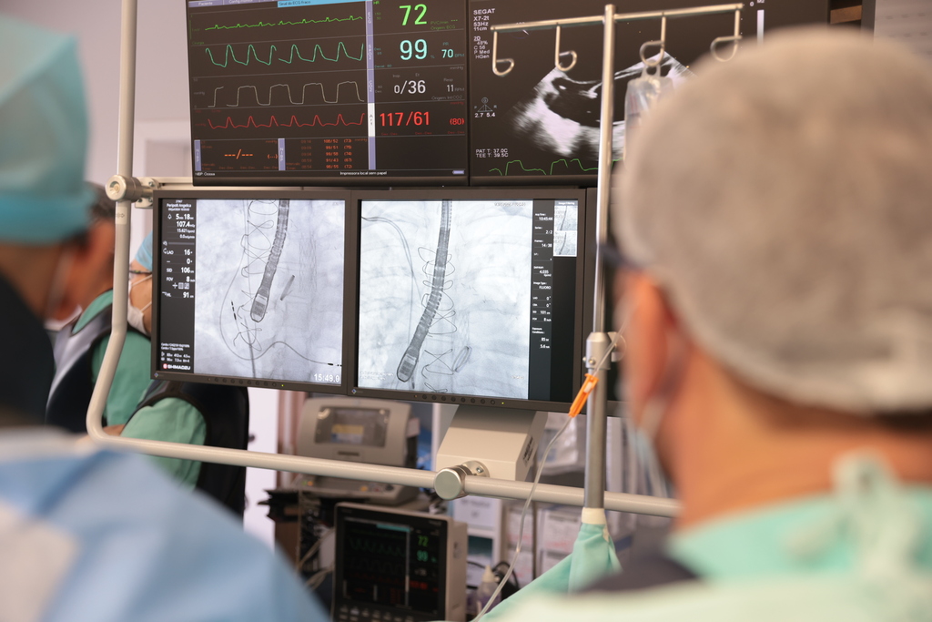 Cirurgias do coração: especialistas se unem para procedimento inédito em Santa Maria
